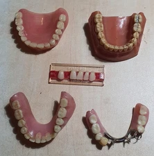 Vintage Dentures Dental Plates & False Teeth - Dentistry Lot - Medical Prop