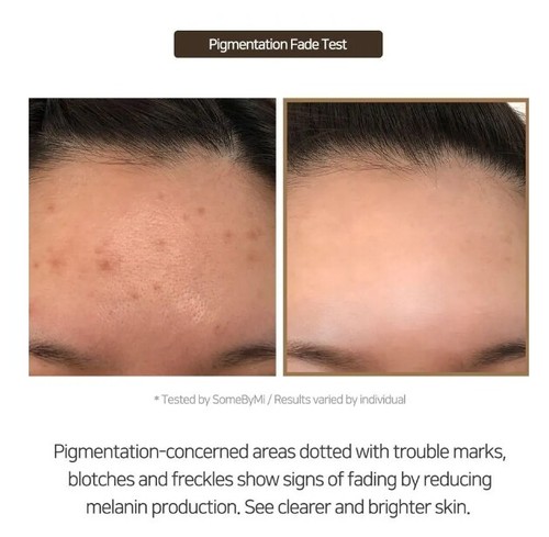 SOME BY MI Galactomyces Pure Vitamin C 10,000ppm Glow Toner 200ml K-Beauty New - Picture 10 of 12