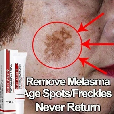 #ad Powerful Spot removing Whiten Cream Pigmentation Melasma Dark Spots $7.30