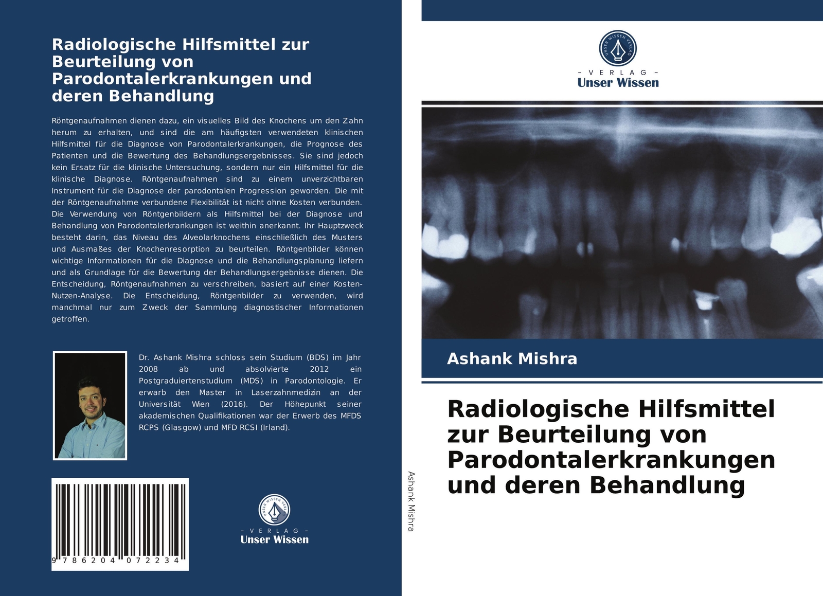 Thumbnail - Radiologische Hilfsmittel Zur Beurteilung Von Parodontalerkrankungen