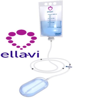 Uterine Balloon Tamponade Ellavi (UBT) For PPH    Free Shipping