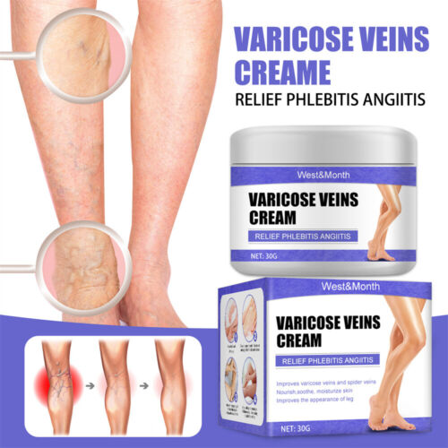 2X Vein Care Fading Cream Varicose Veins Cream for Legs Veins Herbal Ointment - Picture 1 of 8