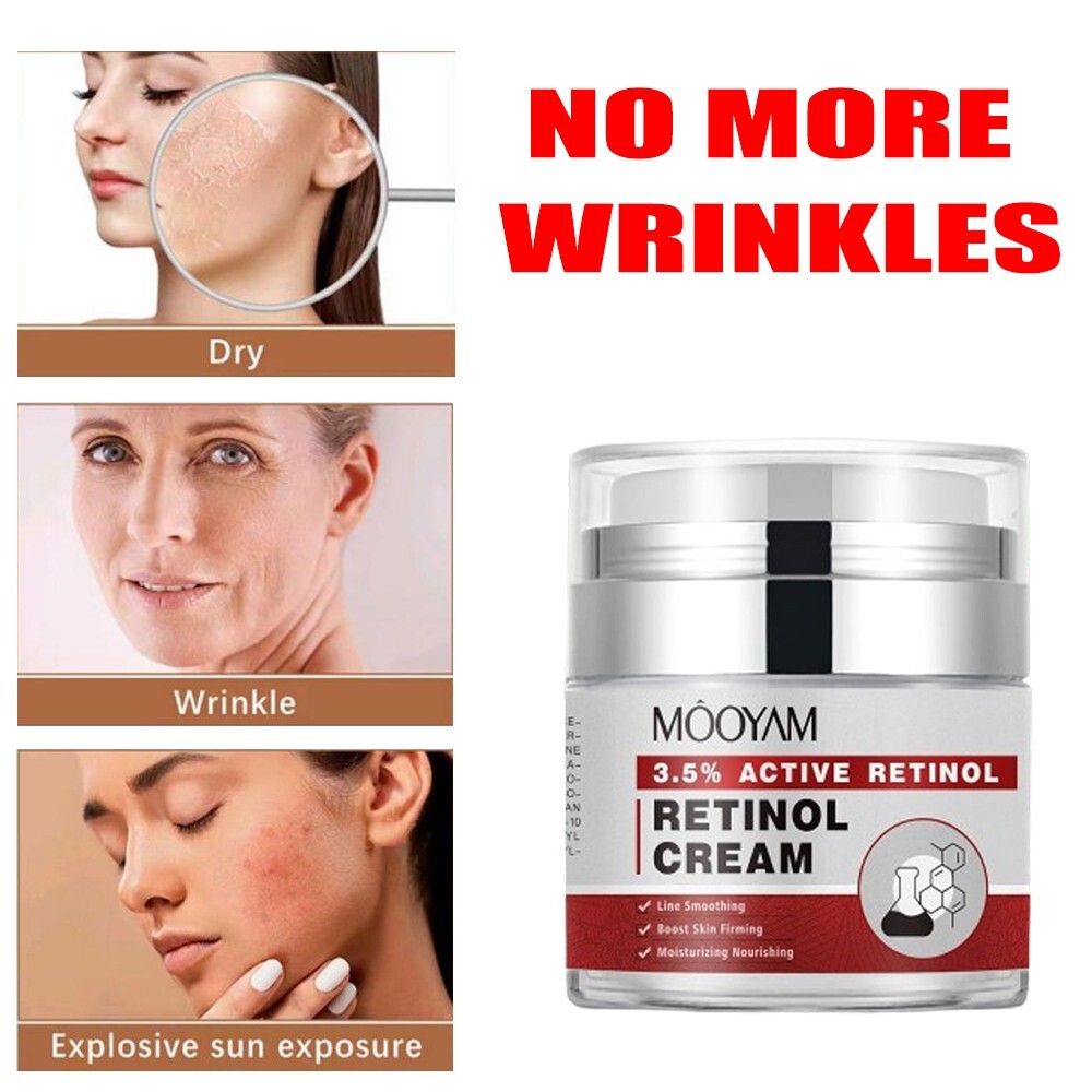 Youth-Boosting Retinol Moisturizer Hydrating Cream 1.7 fl oz