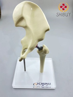1/3 Artificial Hip Joint Replacement Anatomical Skeleton Demo Display Model