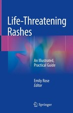 Emily Rose | Life-Threatening Rashes | Buch |...