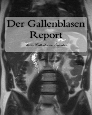 Der Gallenblasen Report: Meine Gallenblasen Operation by Thomas Wittmann (German