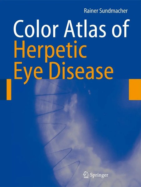 Color Atlas Of Herpetic Eye Disease A Practical Guide To Clinical Management Xvi-image
