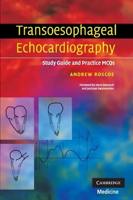 Transoesophageal Echocardiography: Study Guide and Practice MCQs