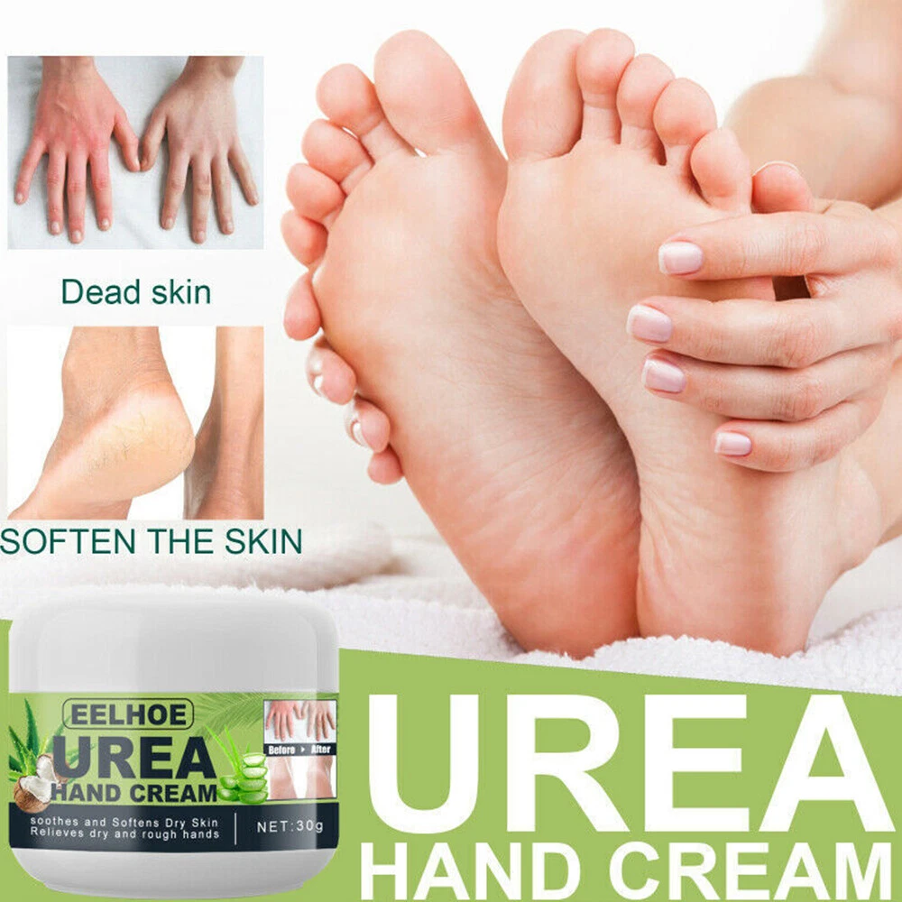 Ellocy Urea 42% Foot Cream for Dry Cracked Heels, Salicylic Acid, 5.29 Oz,  Cracked Heel Repair for Dry Cracked, Callus Remover, nail repair cream,  foot lotion for dry cracked feet