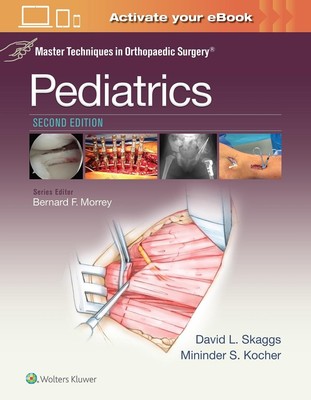 Master Techniques in Orthopaedic Surgery: Pediatrics by David L. Skaggs (English