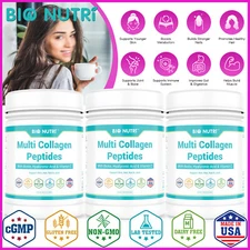 BIO NUTRI Multi Collagen Peptides Powder Type I,II,III,V,X Skin Care Anti-Aging