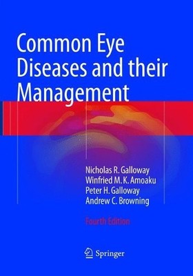 Common Eye Diseases and their Management - 9783319813882