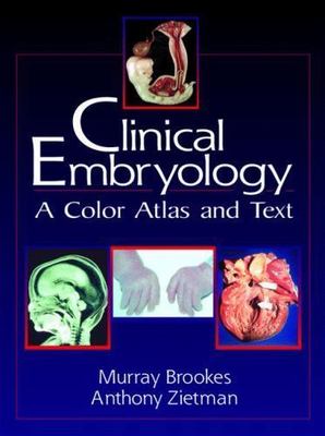 Clinical Embryology: A Color Atlas and Text by Anthony Zietman