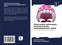 Spontannaq Repoziciq Patologicheski Migrirowawshih Zubow Mala Dixit Baburaj