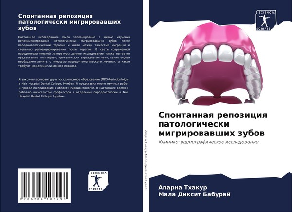 Spontannaq Repoziciq Patologicheski Migrirowawshih Zubow Mala Dixit Baburaj-image