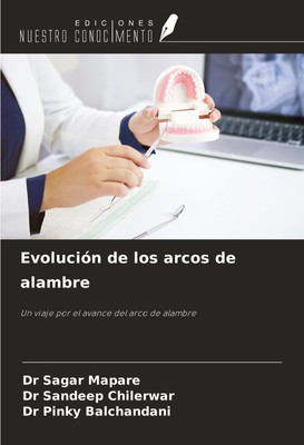 Evolución de los arcos de alambre Un viaje por el avance del arco de alambre