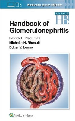Edgar Lerma Michelle Rheault Patrick Henry Handbook of Glomerulon (Taschenbuch)