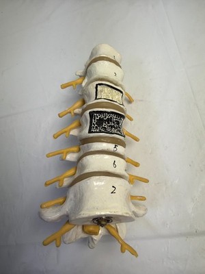 Human Spine Model Lumbar Vertebrae Anatomy Medical Teaching Aid As-Is