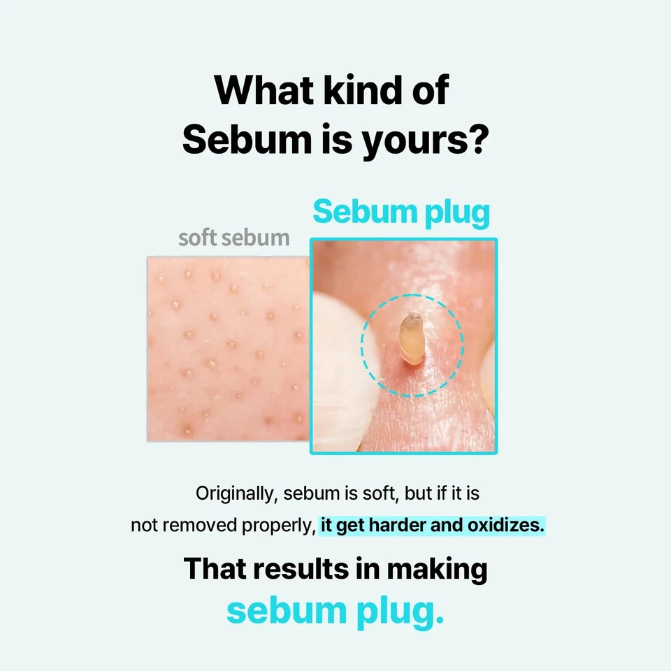 ILSO Super Melting SEBUM Softener to MINIMIZE SEBUM & BLACKHEADS 150毫升 - KBEAUTY — 第 2/4 张图片