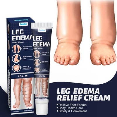 Leg Swelling Anti-Edema Cream Relief Patch Massage Care Crea] Edema Body A3T3