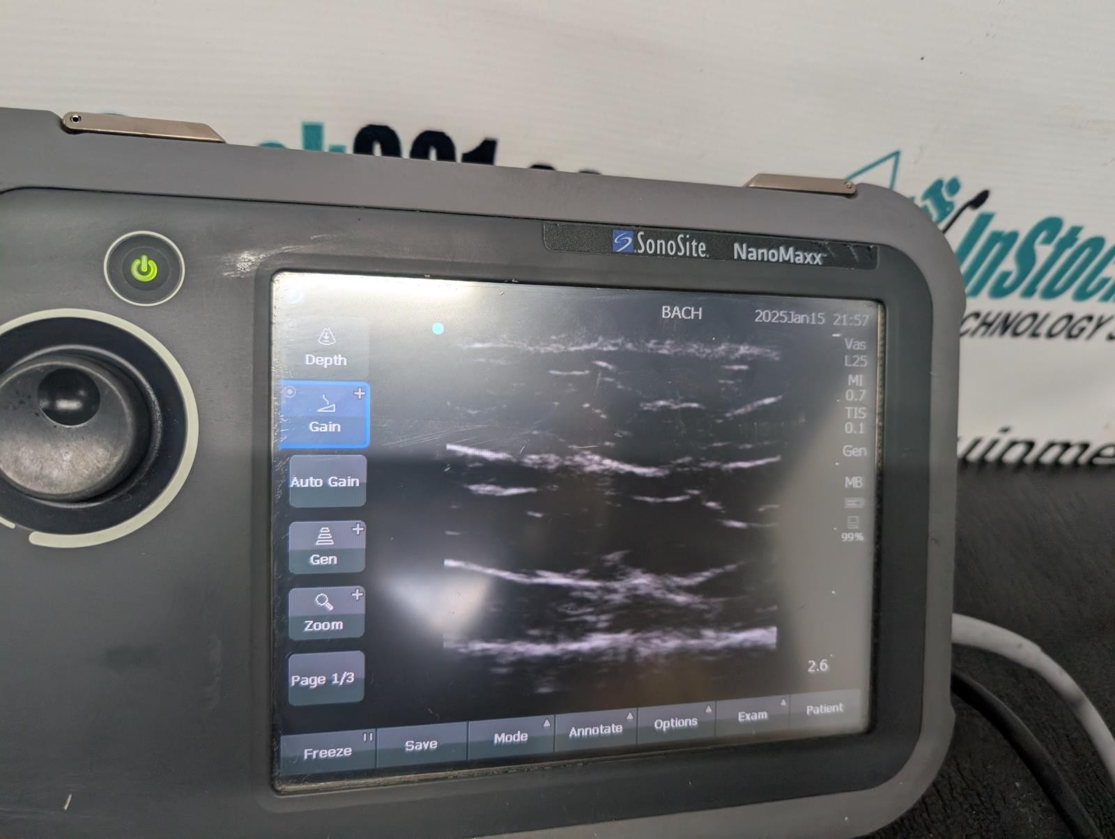 SonoSite NanoMaxx Portable Ultrasound Machine w/ L25, P21 Probes & Power Supply