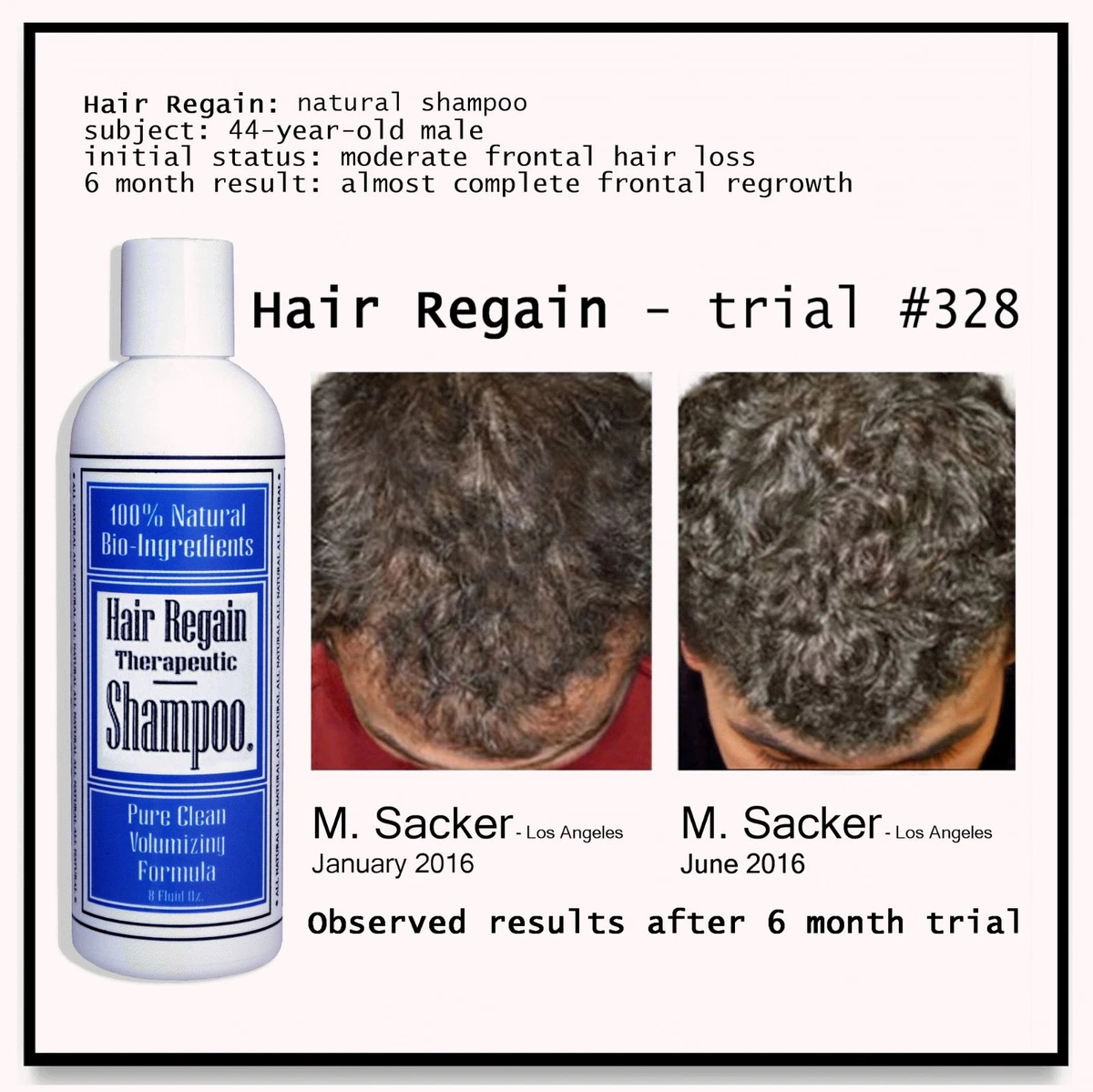 MENS HAIR GROWTH SHAMPOO REGAIN YOUR HAIRLINE IN TWO MONTHS eBay