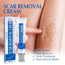 Scar Cream Face & Body Scar Cream Scar Acne Stretch Mark Removal Ointment