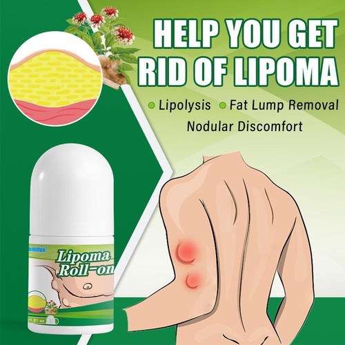30ml Lipomas Cream Cleansing Skin Swelling Cellulite Ointment Skin Care Products - Picture 4 of 10