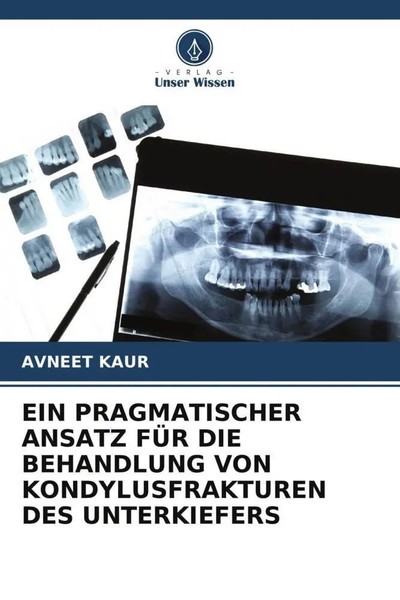 EIN Pragmatischer Ansatz FÜR DIE Behandlung VON Kondylusfrakturen Des...-image