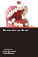 Tarun Gaur (U. A.) | SuccèS Des Implants | Taschenbuch | FranzöSisch (2024)