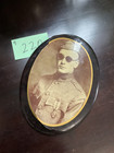 Ww1 Unnamed Photo of what appears to be a mustard gas Victim g220