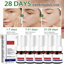 1-5PCWhiting And Freckle Removing Serum Cream Dark Spot Removing Freckle Essence