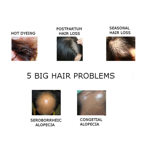 DISAAR Hair Essential Oil Growth Essence Anti Loss Natural Extract Andrea 30g - Picture 8 of 23