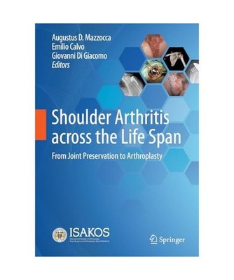 Shoulder Arthritis across the Life Span: From Joint Preservation to Arthroplasty
