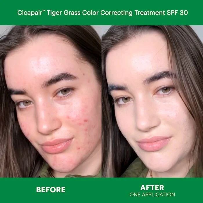 NUEVO Dr. Jart+ Cicapair Kit de Rescate de Enrojecimiento para Piel Sensible Set/100% AUTÉNTICO Foto 4 de 4