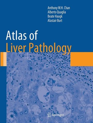 Atlas of Liver Pathology Anthony W. H. Chan (u. a.) Taschenbuch x Englisch 2016