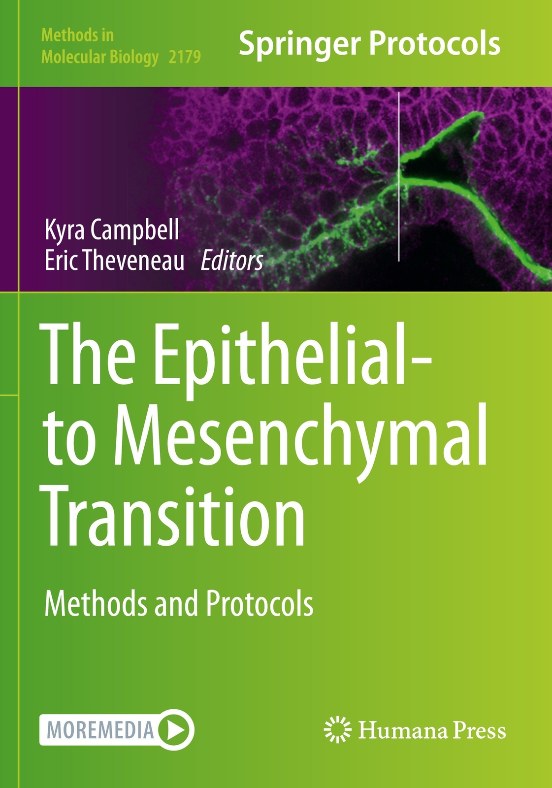 Thumbnail - The Epithelial-to Mesenchymal Transition | Methods And Protocols |