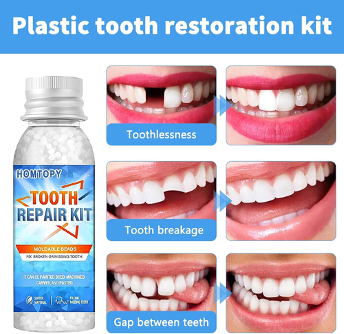 Denti Finti Da Applicare Soli Cemento Dentale Definitivo per Pontefix Faccette D - Foto 2 di 12