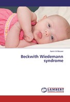 Beckwith Wiedemann Syndrome | Aamir Al Mosawi | Taschenbuch | 80 S. | Englisch