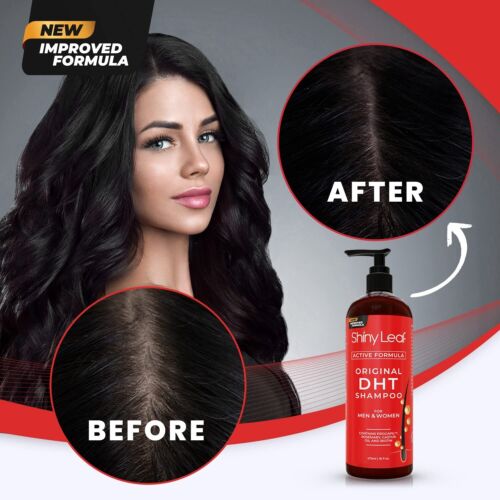 SHINY LEAF DHT BLOCKER SHAMPOO Caffeine Hair Omega Loss Growth 473ml - Picture 6 of 9