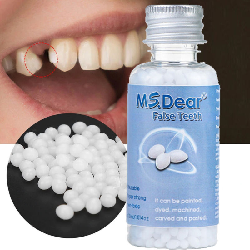 Temporary Tooth Repair Kit - Reusable Moldable Granules For Broken Or Missing Teeth