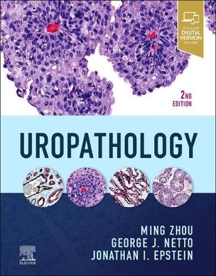 Uropathology by Ming Zhou, George Netto, Jonathan I Epstein - 9780323653954