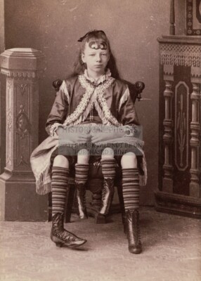 MYRTLE CORBIN FOUR LEGGED GIRL CIRCUS CARNIVAL SIDESHOW FREAK 5X7 PHOTO