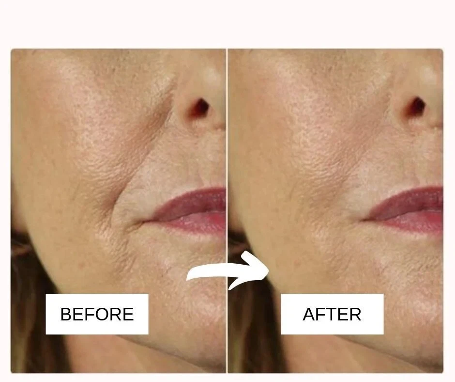 Himalaya Anti-Wrinkle Cream For Men/Women Reduce Wrinkles, Fine Lines & Age Spot - Image 2 of 4