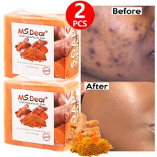 2PCS Turmeric Soap Skin Whitening Dark Spots Lightening Acne Brightening Tumeric