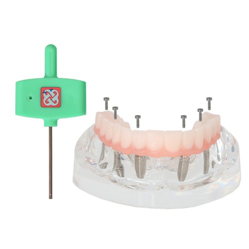 US M6001-2 Dental Implant All-on-6 Upper Jaw Restoration Model with 6 Screws - Picture 6 of 12