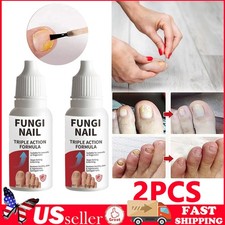 Toenail Fungus Treatment Liquid, Fungi Nail Anti-Fungal Liquid 15ml