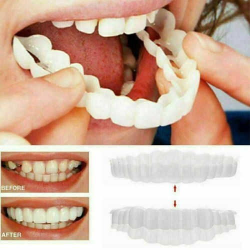 ﹑Snap On Top & Bottom False Teeth Veneers Covers Instant Clip Up Cosmetic Smile - Picture 5 of 12