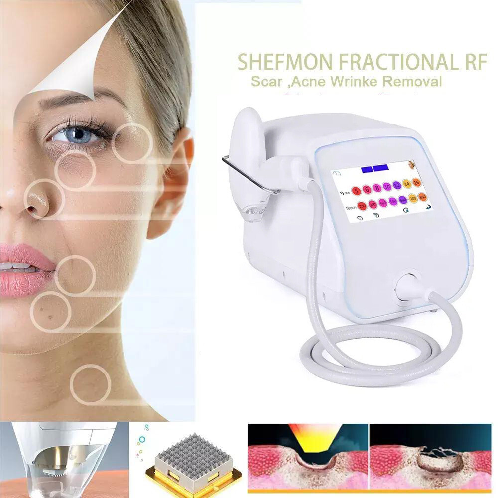 Máquina Tixel 400°C Natural Térmico Fraccional Piel Apriete Eliminación de Estrías