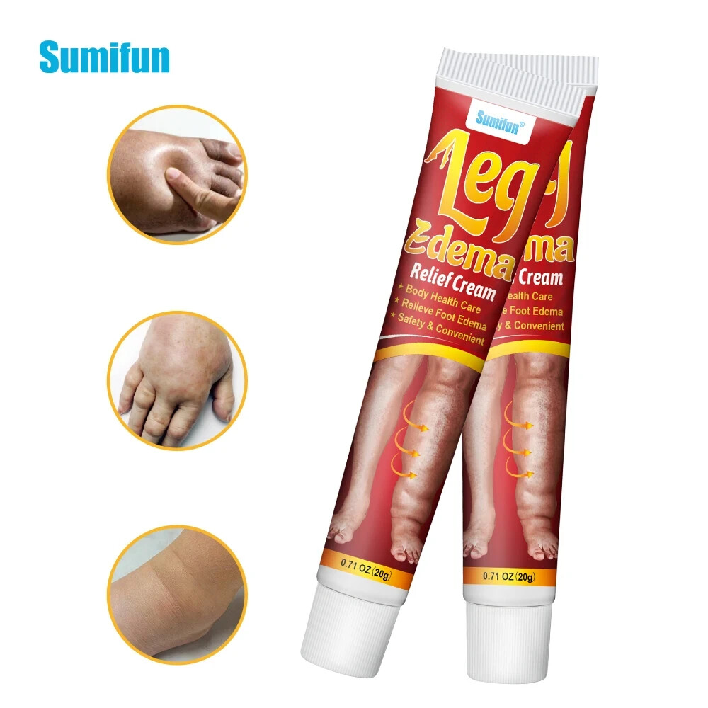 20g New Natural Anti Edema Cream Remove Arm Leg Swelling Pain